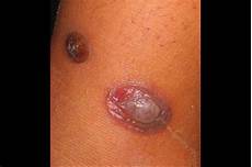 Grill Thigh Without Skin