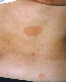 Grill Thigh Without Skin