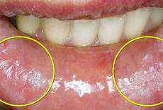 White Chewing Gum